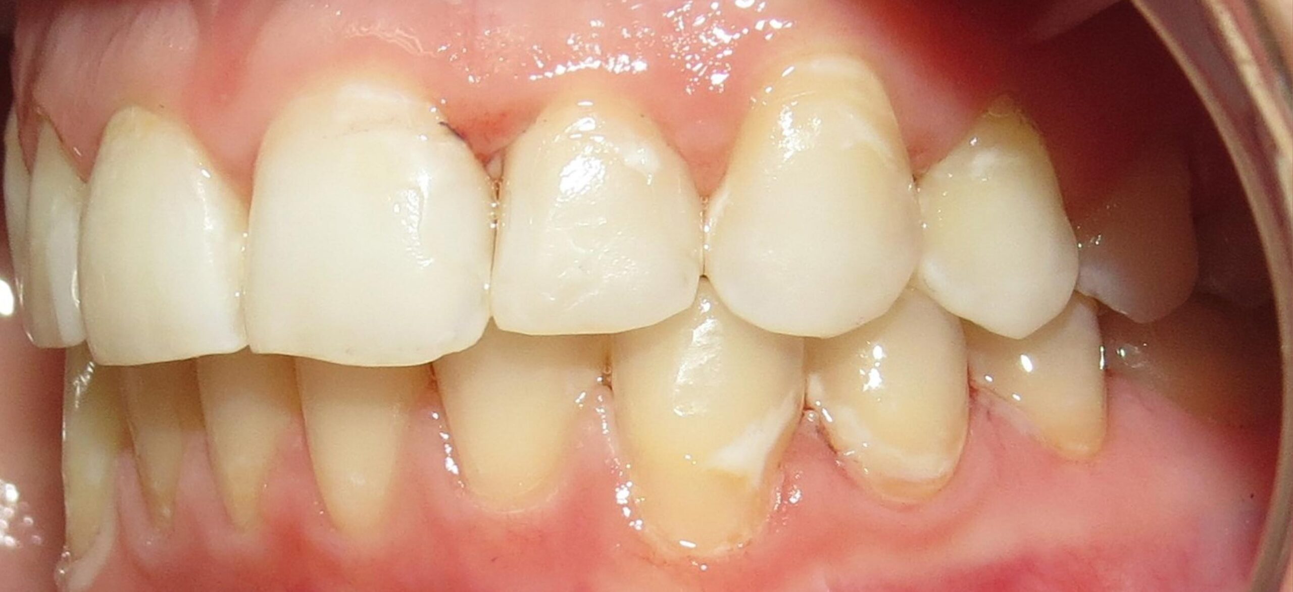 Picture-1