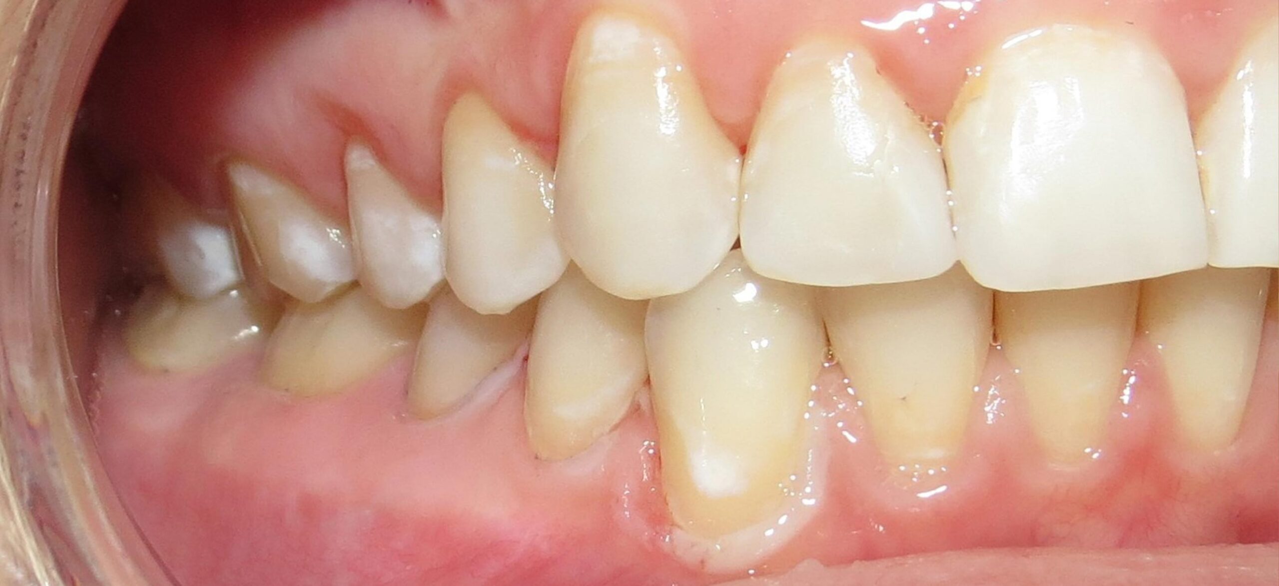 Picture-3