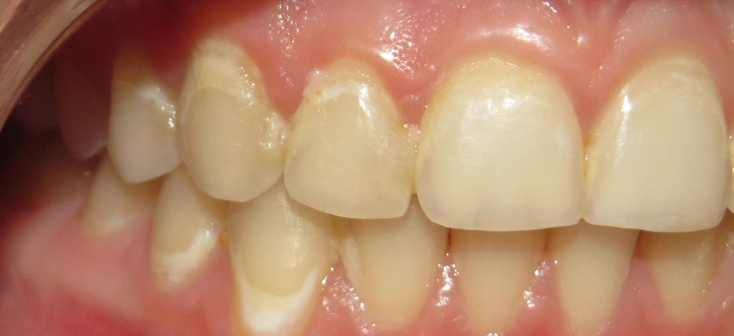 Picture-4