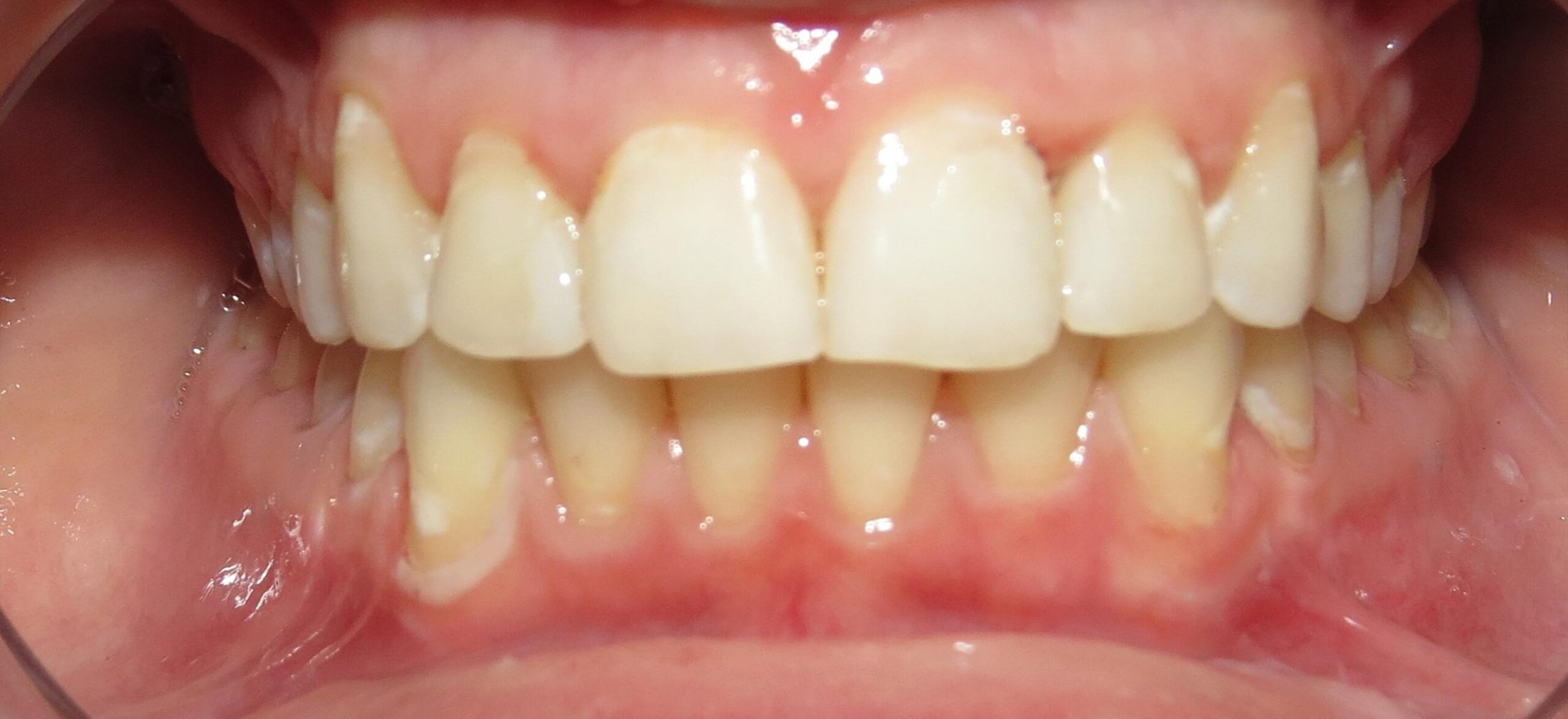 Picture-5